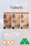 Naturix Kojik Asitli Yüz Serumu Aydınlatıcı Bakım Serumu 30 ml